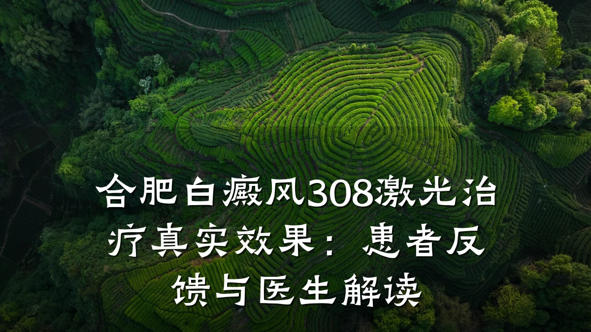 合肥白癜风308激光治疗真实效果:患者反馈与医生解读